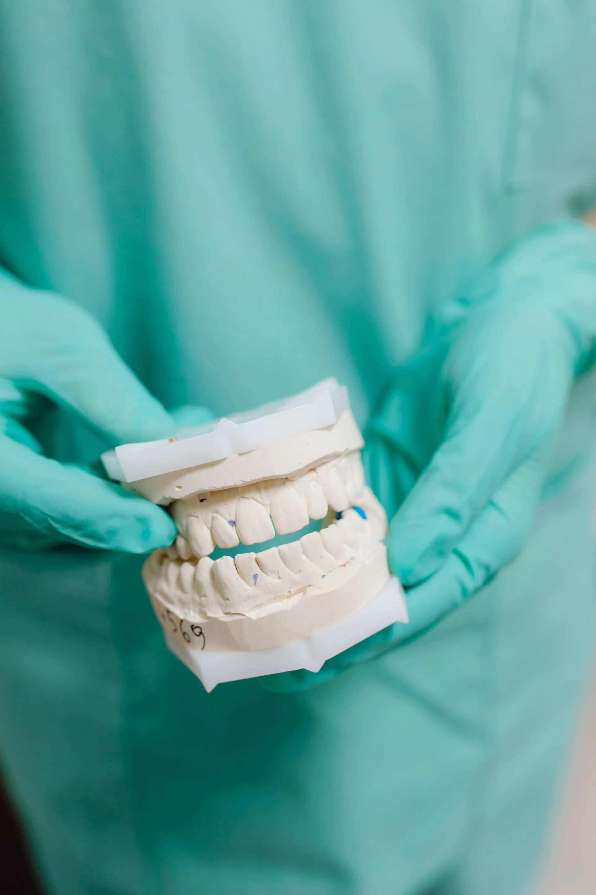 Profesional dental sosteniendo un molde de escayola con la dentadura completa